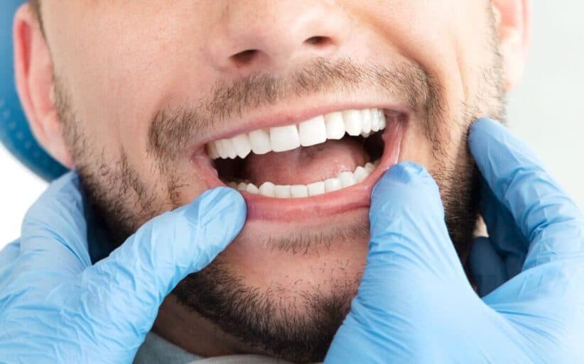 Síntomas de la periodontitis