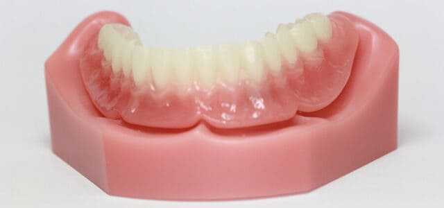 Implantes en toda la boca