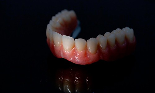 Prótesis dental