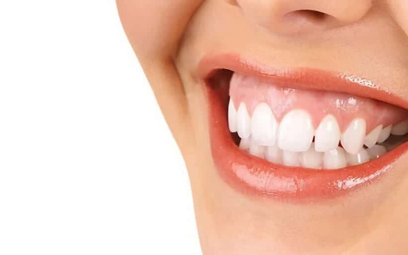 Cómo arreglar la sonrisa gingival