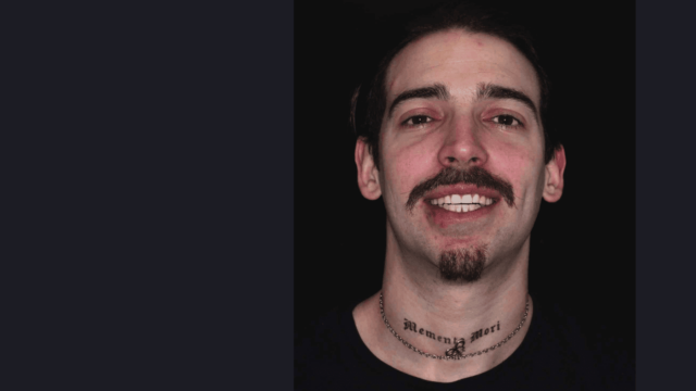 Caso real con brackets