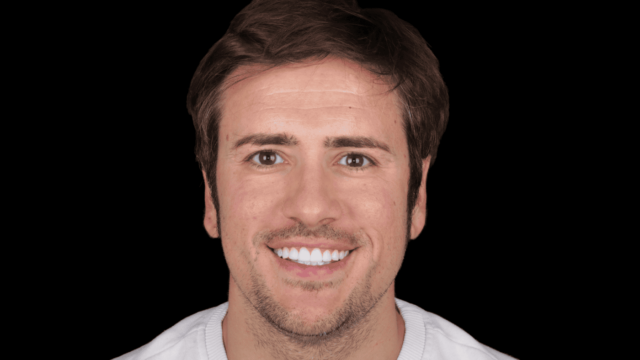 Caso real estética dental