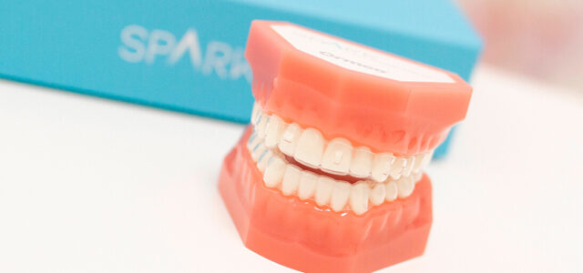 Ortodoncia transparente Spark Spark