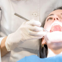 Taurodontismo endodoncia