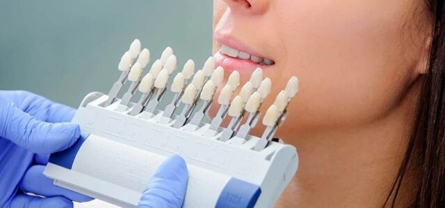 Por qué salen las tinciones en los dientes Cómo eliminar las manchas en los dientes