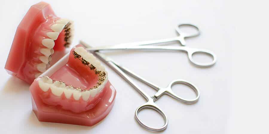 cuanto cuesta ponerse brackets en republica dominicana 2020 cuanto cuesta ponerse brackets en republica dominicana 2020
