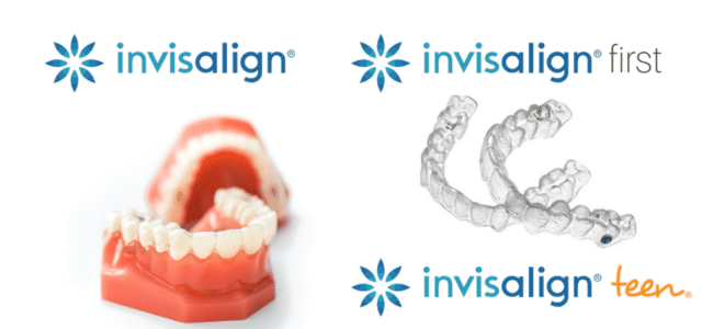 Tipos de Invisalign