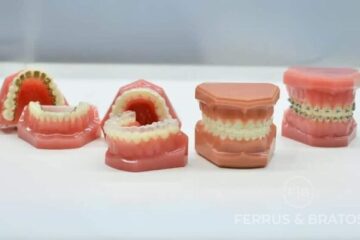 distintos tipos de ortodoncia