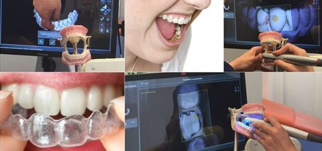 Tipos de tratamientos ortodoncia Ortodoncia en Clínica Ferrus & Bratos