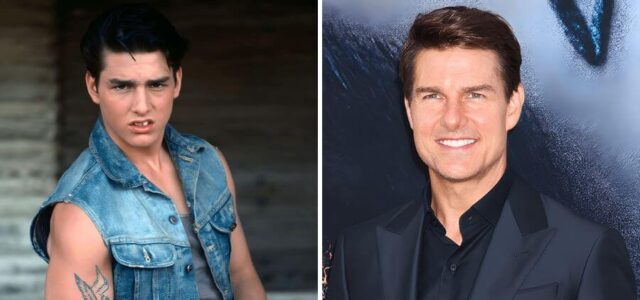 Tom Cruise con carillas dentales