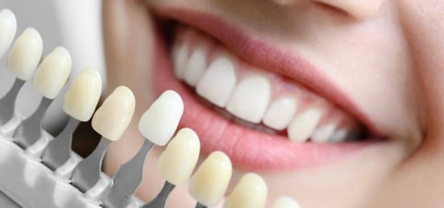 Cada persona tiene su propio color dental