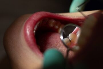 Gingivitis Y Periodontitis Durante El Embarazo Ferrusbratos