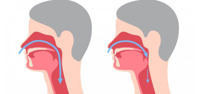 OrthoApnea: la solución a la apnea y los ronquidos